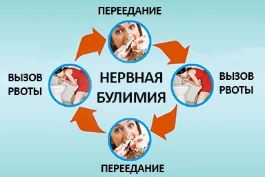 Лечение булимии в Богородском
